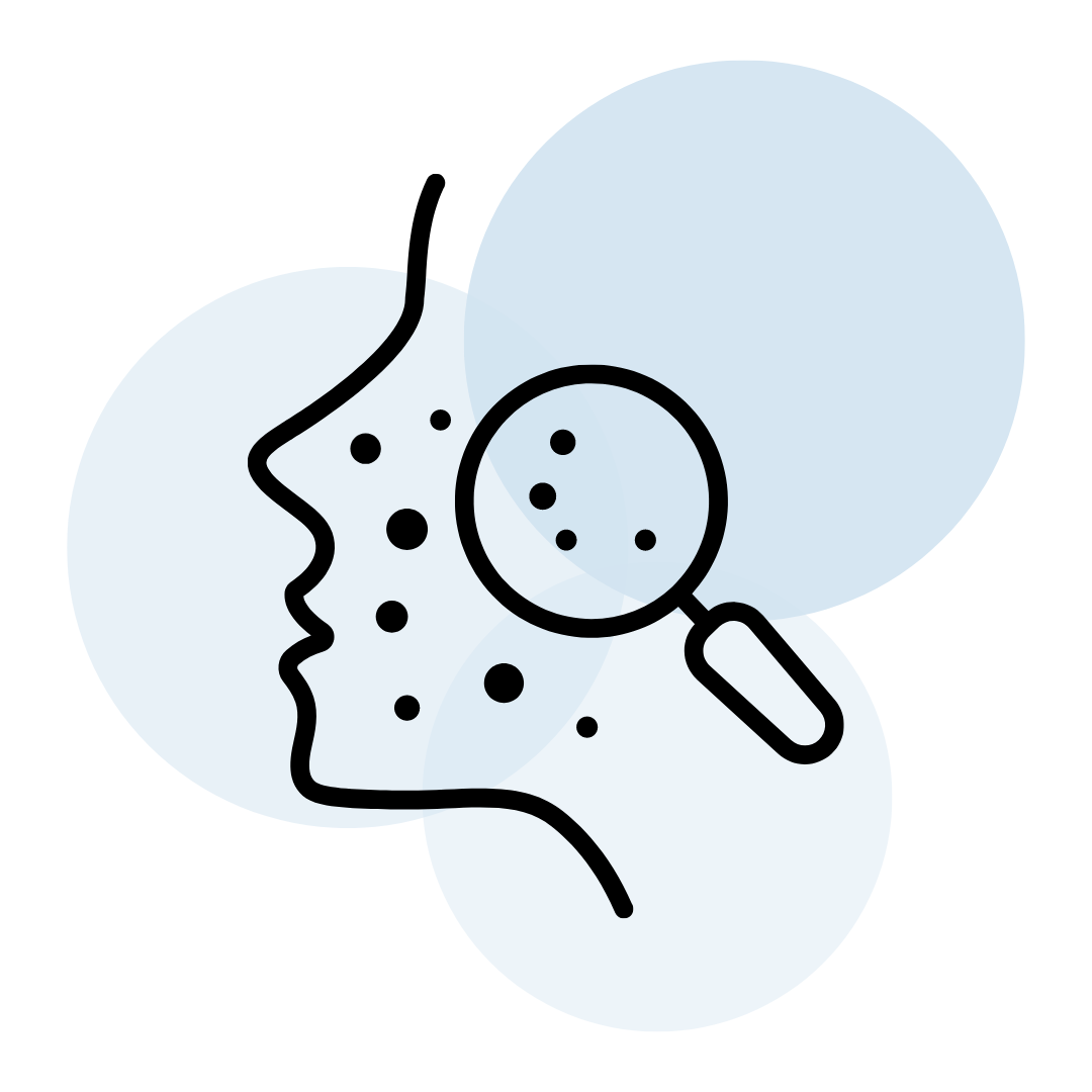 Icon of a cartoon face with acne and a magnifying glass over three lightly transparent blue circles