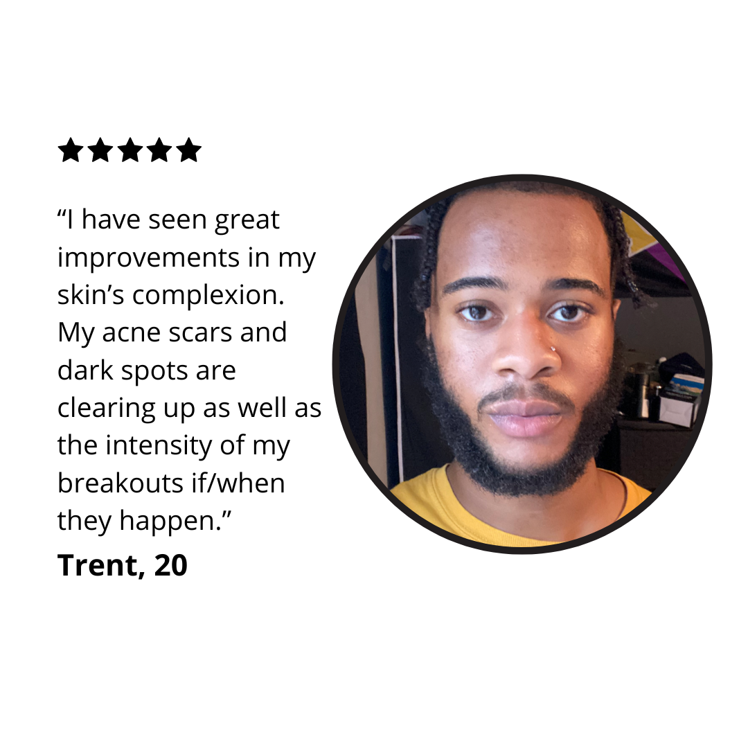 A review photo of a customer named Trent stating "I have seen great improvements in my skin's complexion. My acne scars and dark spots are clearing up as well as the intensity of my breakouts if/when they happen."