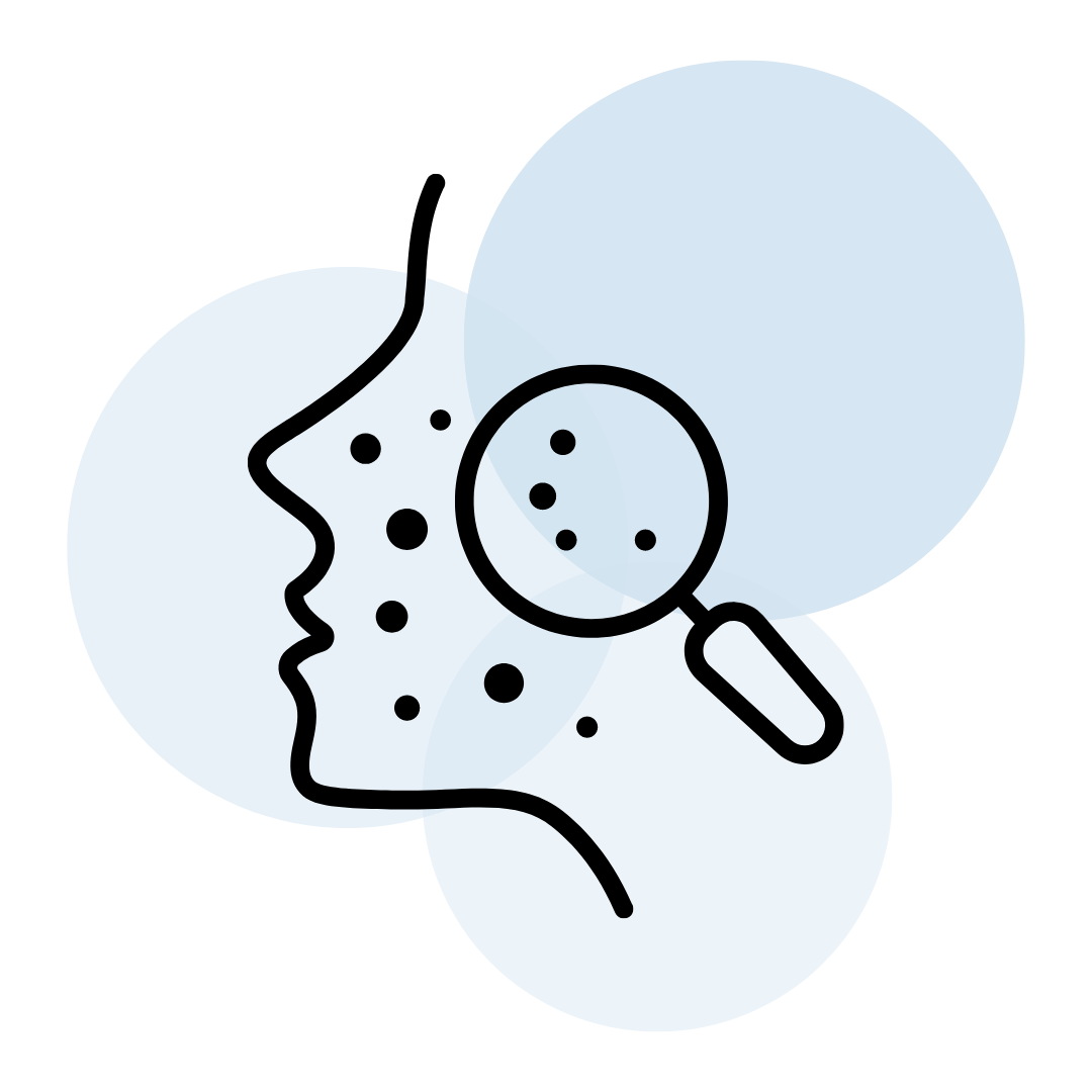 Icon of a cartoon face with acne and a magnifying glass over three lightly transparent blue circles 